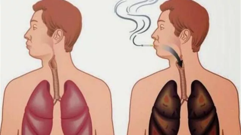 5 مشروبات لتنظيف الرئة.. تعرف عليها