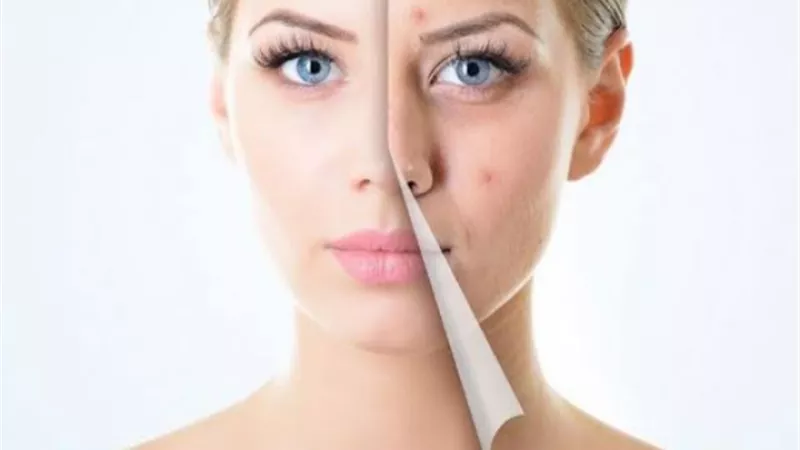 لا داعي لمراكز التجميل.. خلطات طبيعية لعلاج مشاكل البشرة