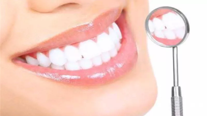 روشته من أطباء الأسنان للوقاية من التسوس