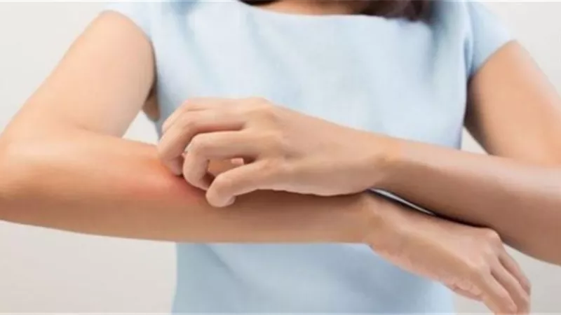 هل الطفح الجلدي من أعراض فيروس كورونا؟.. إليك الإجابة