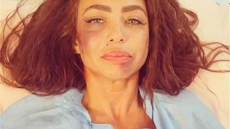 تطورات الحالة الصحية لـ دوللى شاهين بعد الاعتداء عليها بالضرب من قبل مجهولين
