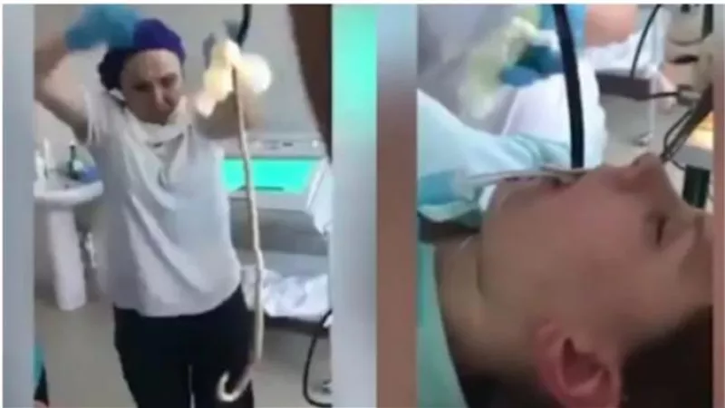 فيديو مرعب.. شاهد لحظة إخراج ثعبان ضخم من فم سيدة روسية