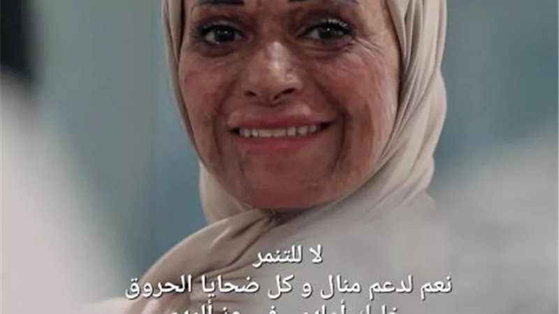 تعرف علي منال حسني .. ناجية الحروق التي تضامن معها الالاف علي مواقع التواصل الأجتماعي
