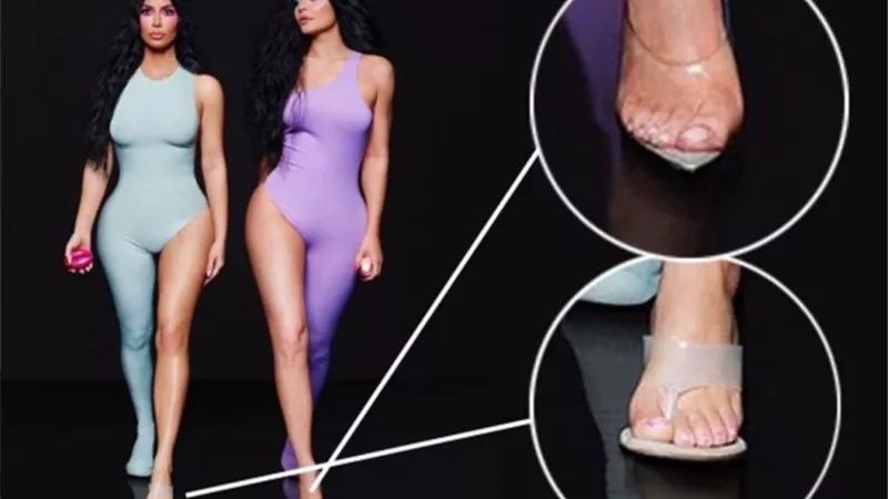 وجود 6 أصابع فى قدم « كيم كارداشيان» .. شائعة أم حقيقة