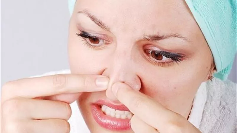 بالخيط والبخار.. الحل المثالي لإزالة الرؤوس السوداء من الأنف