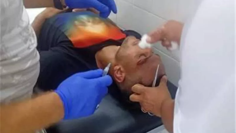 مهاجم الاتحاد يخضع للجراحه عقب مباراة المقاولون العرب