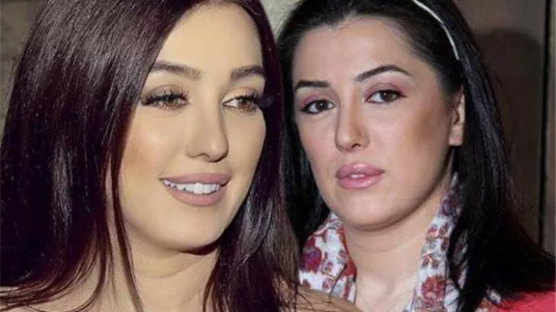 طبيبة التجميل الخاصة بكندة علوش تكشف عدد عمليات التجميل التي خضعت لها