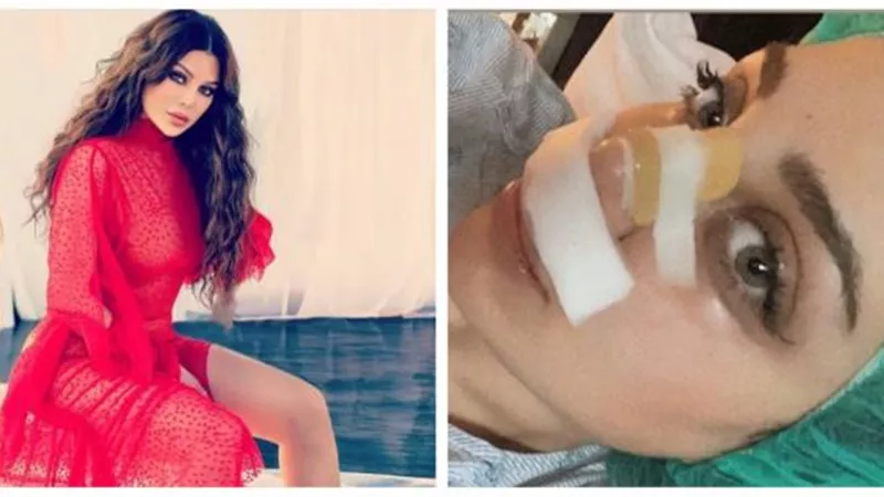 أول صور لإبنة هيفاء وهبي بعد تشوه أنفها بسبب عمليات التجميل