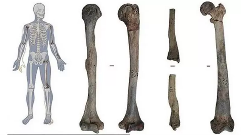 عصور ما قبل التاريخ.. العثور على أقدم حالة هشاشة عظام عمرها 6600 ألف عام فما قصتها؟