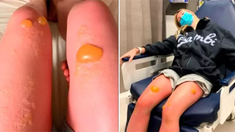 أسترالية تٌحذّر من أمر يفعله الكثيرون: جعلني أهلوس مثل كائن فضائي
