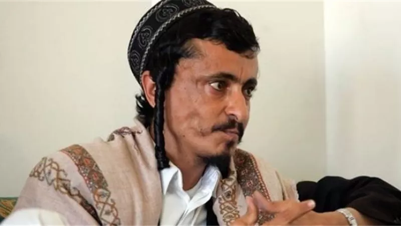 أمريكا تتحرك لإنقاذ يهودي يمني محبوس عند الحوثيين من 4 سنوات