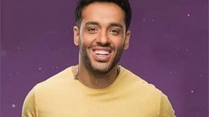 رامى جمال عن البهاق: المرض ميزة مش عيب