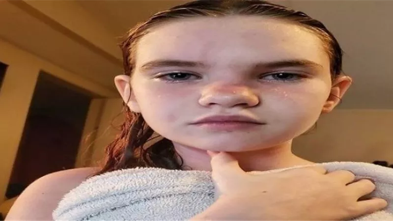 هذه الفتاة إذا ”استحمت” أو غسلت وجهها ستموت