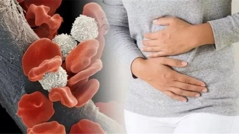 جمعية سرطان الدم تدق جرس الإنذار..  هذه الأعراض دليل على الإصابة بالمرض