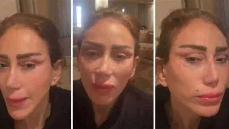 مفاجأة.. اعتزال ريهام سعيد بعد تشويه وجهها