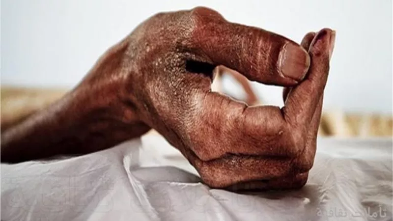 تقرير خطير لوزارة الصحة حول المتعايشين مع «الإيدز »فى مصر