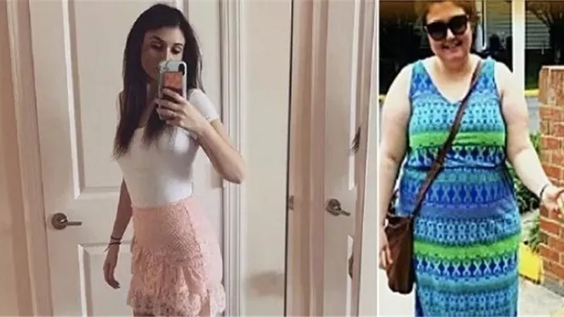 لتحقيق حلمها بأن تصبح عارضة أزياء.. فتاة تفقد 50 كيلو من وزنها