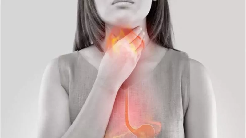 بدون أدوية.. روشتة سريعة لعلاج الحموضة