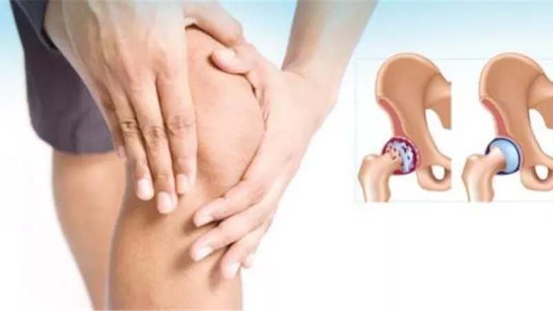 هذه الأطعمة.. روشتة سحرية لعلاج التهاب المفاصل
