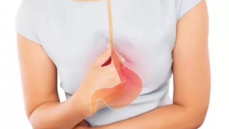 كيف تتجنب الشعور بالحموضة في عيد الأضحى؟