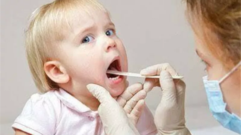 ما هي الأعراض المبكرة لالتهاب اللوز عند الأطفال؟