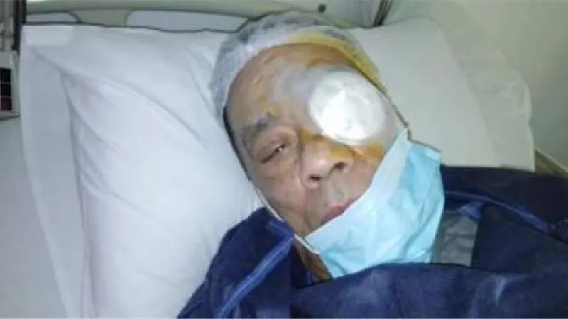 بعد إجرائه عملية جراحية خطيرة.. آخر تطورات الحالة الصحية لـ حلمي بكر