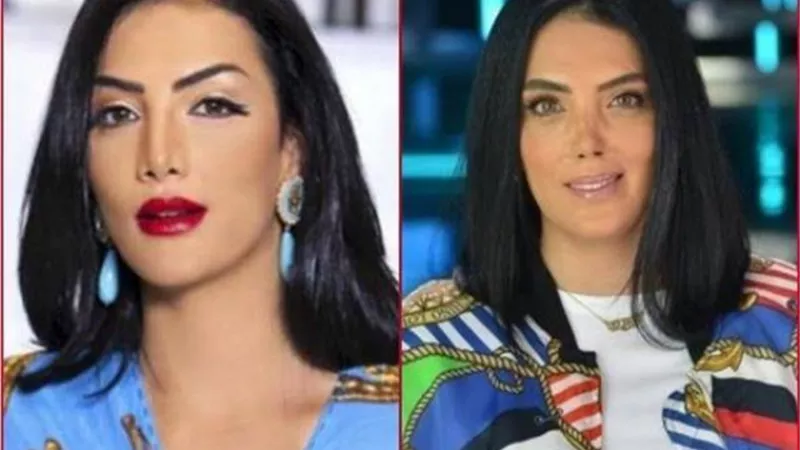 عاجل.. سر اختفاء حورية فرغلي بعد العملية الثانية