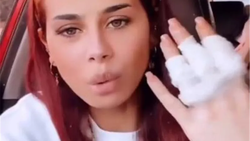 منة عرفة لجمهورها : ”كفاية قر” عملت حادثة بالعربية وعندي التهاب حاد في الغدة وكلابي بتموت