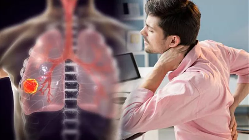 تعرفي على أسهل طريقة لعلاج سرطان الرئة