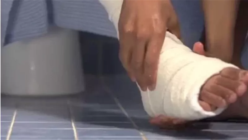 هل يجوز المسح على القدم الموضوعة في الجبس عند الوضوء ؟.. الإفتاء تجيب