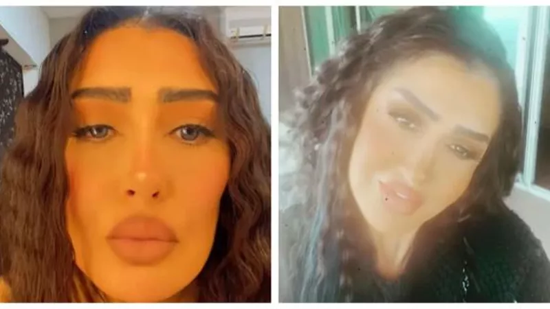 7 عمليات تجميل فاشلة.. تشوه وجه غادة عبد الرازق مدى الحياة (صور)