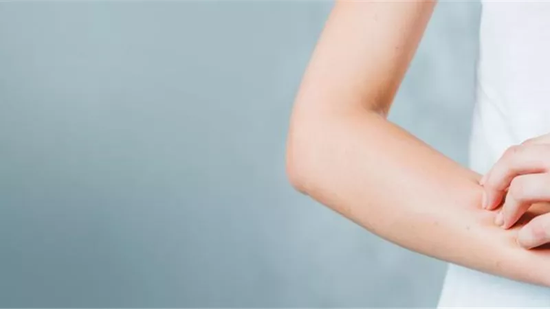 وزارة الصحة تحذر من حساسية الحليب.. تعرف على الأعراض والعلاج
