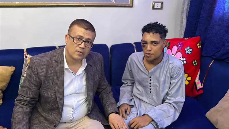 وزير العمل يوجه بصرف تعويضات عاجلة للعمال المصابين بحادث سقالة الجيزة