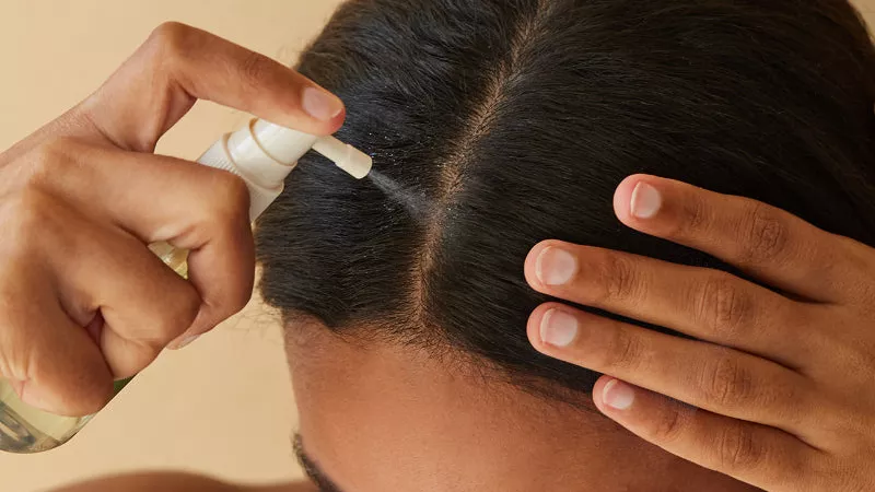 هام للسيدات.. خلطات منزلية تساعد في علاج الصلع الوراثي