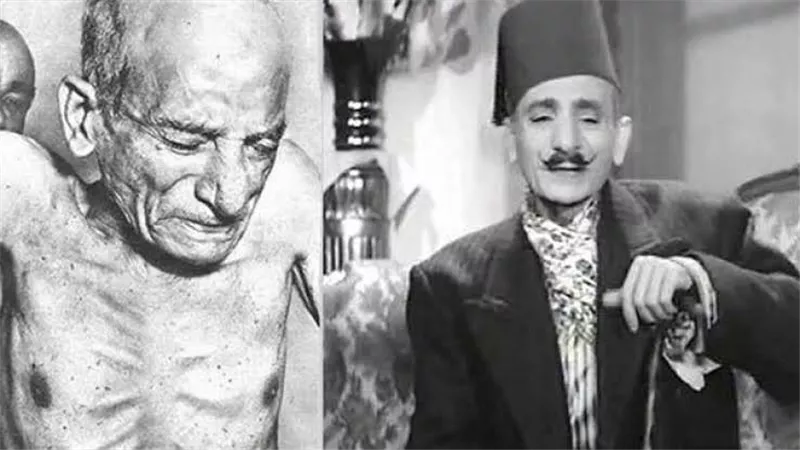 محمد كمال المصري..شرفنطح الكوميديا الذي أبهر الجماهير وانتهت حياته بمأساة 