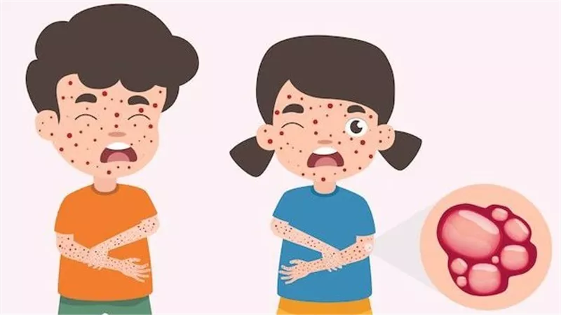 وضع عناوين اقرأ أيضاً......... احمي طفلك من الأمراض المعدية في المدرسة وتعرف على طرق الوقاية