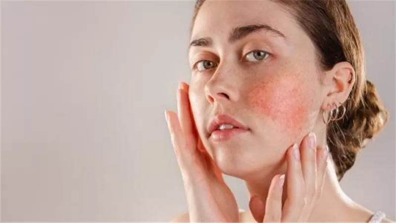 حلول سحرية لعلاج حبوب الوجه والحساسية بعد سن الثلاثين