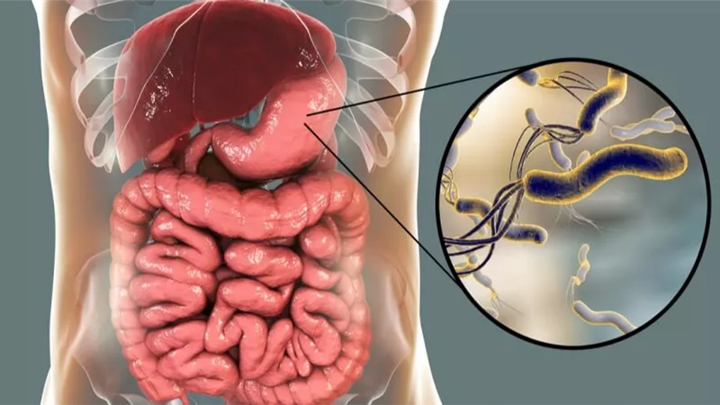 أفضل طرق علاج جرثومة المعدة وتجنب مضاعفاته الخطيرة