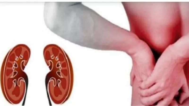أبرزها المسكنات.. ما هى أسباب الفشل الكلوي؟