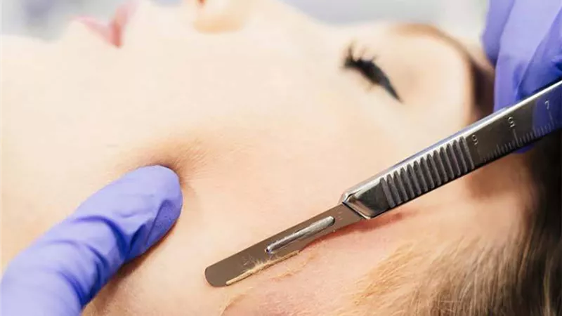 الديرما بلانينج.. تقنية حديثة لتقشير البشرة وإزالة الشعر الزائد