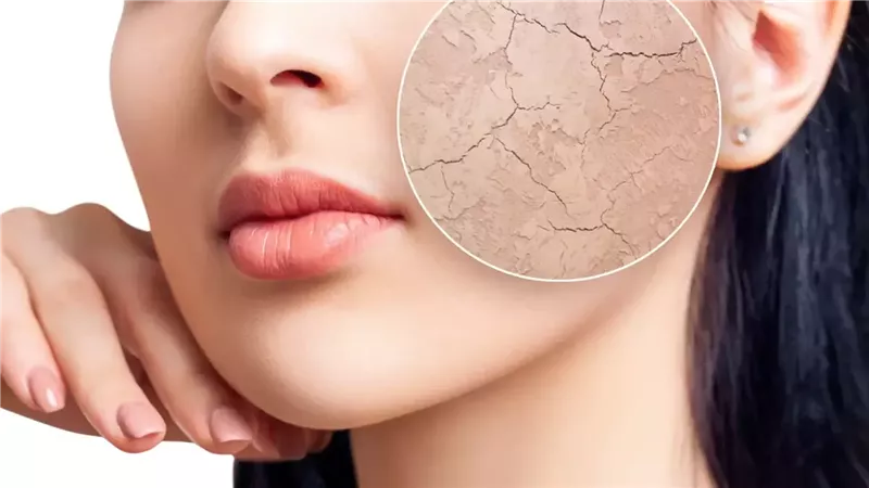 نصائح للقضاء على الجفاف وتقشير الجلد .. للحصول على بشرة رطبة 