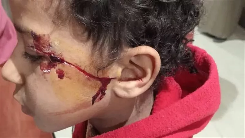 تفاصيل إصابة طفل بمدرسة مجمع شطورة في سوهاج بآلة حادة