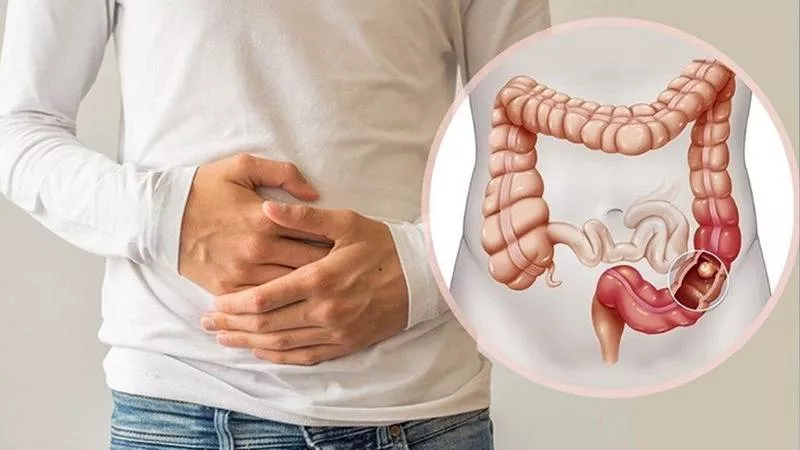 وداعًا لآلام القولون العصبي.. اختبار دم يكشف الأطعمة المُهيجة