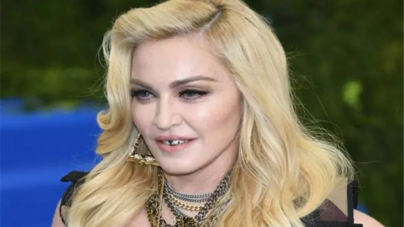 مادونا لا تكف عن إغراء جمهورها رغم إصابتها في ركبتها