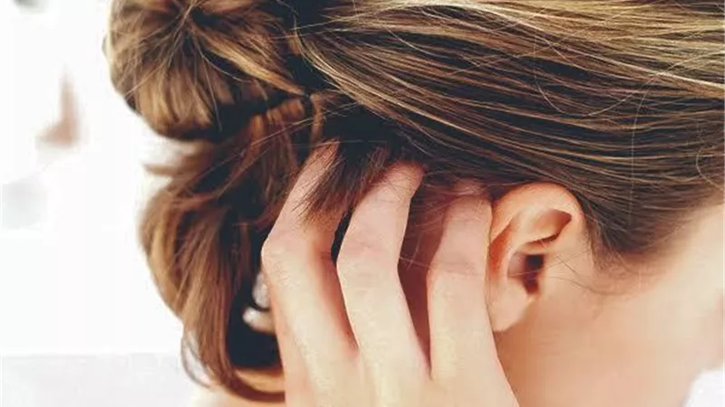 كيف تعالج حكة فروة الرأس ب 5 طرق