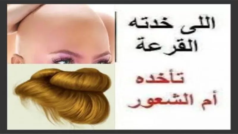 ”اللي اخدته القرعة تاخده أم الشعور”..رجل قبيح وزوجة مخلصة وراء المثل